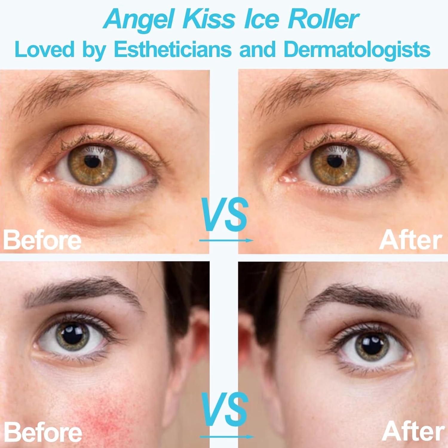 imageAngel Kiss Ice Roller for Face Eye Women Gift Idea Cold Therapy Massager for Reduce Puffiness Redness Dark Circles Tightening Firming Reduce Wrinkles Migraine Pain Relief wPremium Carry CaseBlue Roller