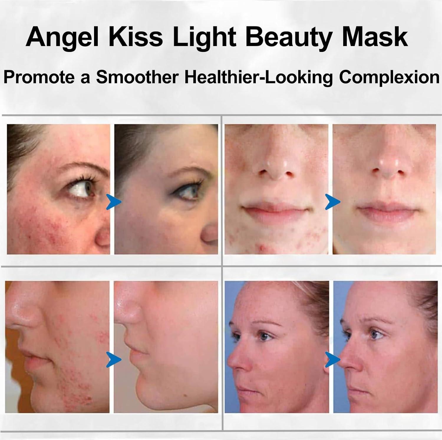 imageAngel Kiss Light Beauty Mask Led Face Mask Light Therapy Red Light Therapy Mask for Face LED Facial Skin Care MaskWhite